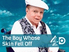 Watch The Boy Whose Skin Fell Off Online Free